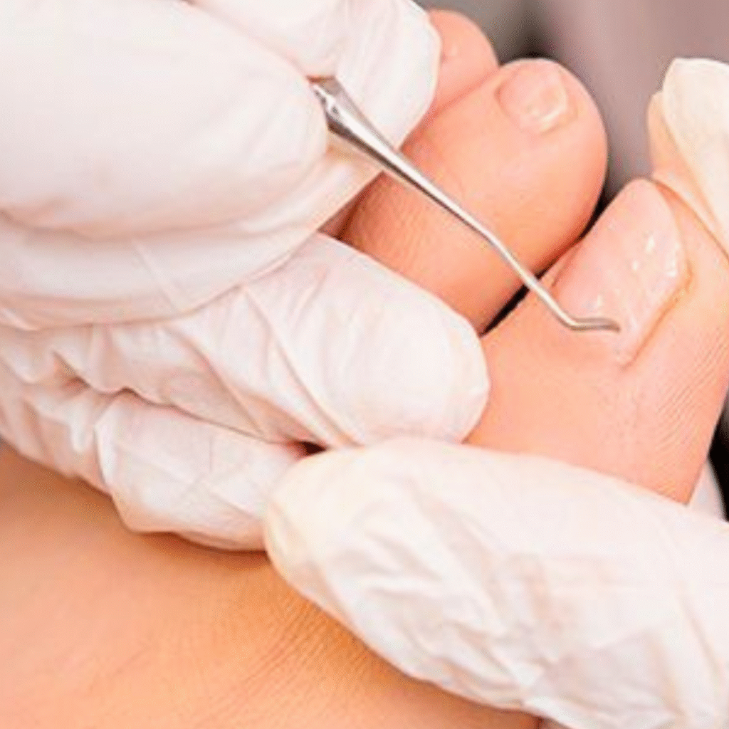 servicios de podología Orihuela