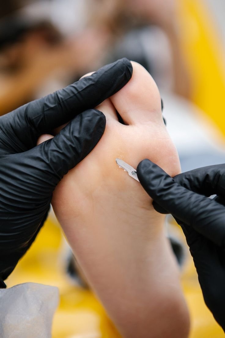 podología en Orihuela